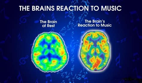 can i listen to music with a concussion? the impact of sound on the brain during recovery